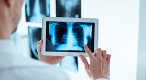 Digital X-RAY